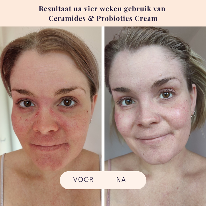 Crème aux Céramides et Probiotiques - Flow Cosmetics - 50 ml