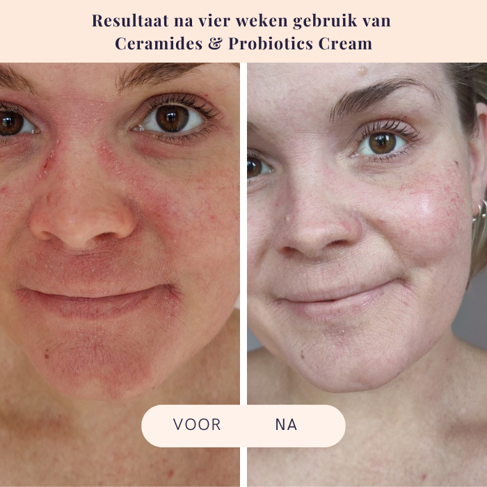 Ceramides & Probiotics Cream - Flow Cosmetics - 50ml