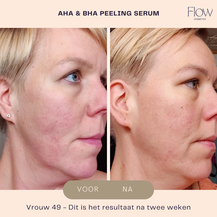 AHA & BHA Peeling Serum - Peeling gezicht - Flow Cosmetics - 30ml